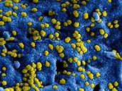 nieuw_coronavirus_in_china nieuw_coronavirus_in_china